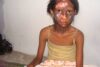 Mädchen erlitt Verbrennungen beim Pogrom von 2008